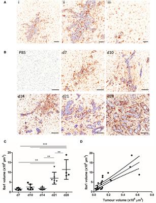 Anti-inflammatory Microglia/Macrophages As a Potential Therapeutic Target in Brain Metastasis